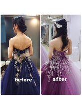美容矯正専門サロン アカデミア(ACADEMIA)/花嫁様before after#巻き肩改善4