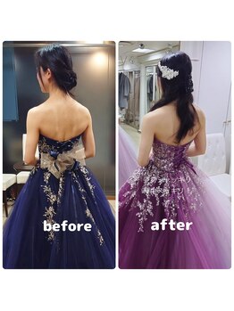 美容矯正専門サロン アカデミア(ACADEMIA)/花嫁様before after#巻き肩改善4