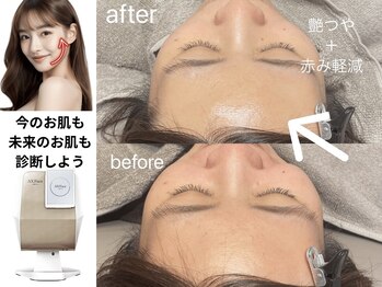 トゥミー 大宮店(to/me)/眉毛大宮/まつげパーマ/毛穴大宮