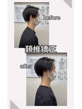 ニューカイロプラクティック カネヨシ/首の矯正のbefore/after