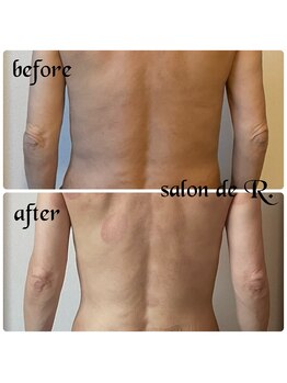 サロン ド アール(salon de R.)/【お背中骨氣・50代・施術効果】
