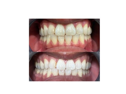 ラポ(Lapo)の写真