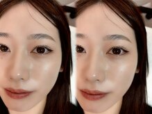 Aminyパリジェンヌ/バインドロック/フラットラッシュ/LED/マツエク/まつげパーマ/眉毛/まつげパーマ/マツパ/新宿