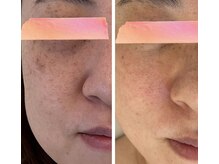 アイラッシュ ネイル ココ(COCO)の雰囲気（シミ・シワ・たるみ・くすみ・毛穴たるみ・小顔・角質ケア☆）