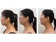 ビューティルーム ミセル(beautyroom miseru)の写真