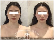 美極 銀座店/銀座/小顔コルギ/小顔矯正