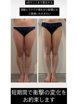 エムプリュ 心斎橋店(M.plus)/2回でここまで変化！！