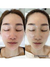 ブリス(Bliss)/エキスパートスタイルヘッドスパ