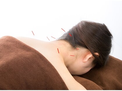 こいわ鍼灸院ハリコア(HARICORE)の写真