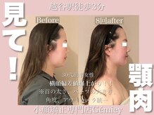 ジェイミー(Gemiey)/横顔偏差値爆上がり！！