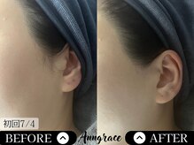 アングレイス(Anngrace)/