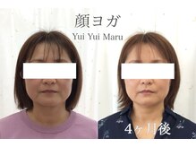 ユイユイマール(Yui Yui Maru)/自分の力で小顔はつくれる！