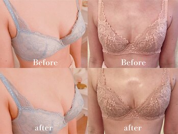 ローズルート(Rose route)/←20代後半 →30代前半 バスト