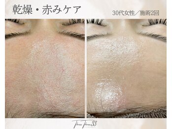 スリースリー(THREE THREE)/乾燥・赤みケア