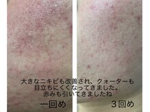 ビキャット(Be cat)/VOSサロンケア　ブラック