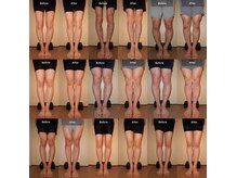 O脚やX脚の改善例はウェブサイトにもたくさん載せています