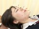 八尾わだち整骨院の写真/ニキビケア・シワたるみ改善や小顔など、お顔の血行促進でいつもの化粧水が入りやすいお肌に◎【美容鍼】