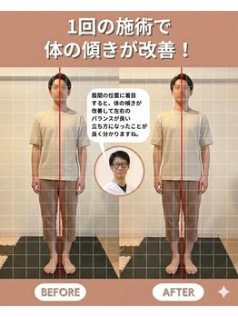 のなか整体院/整体 Before→After