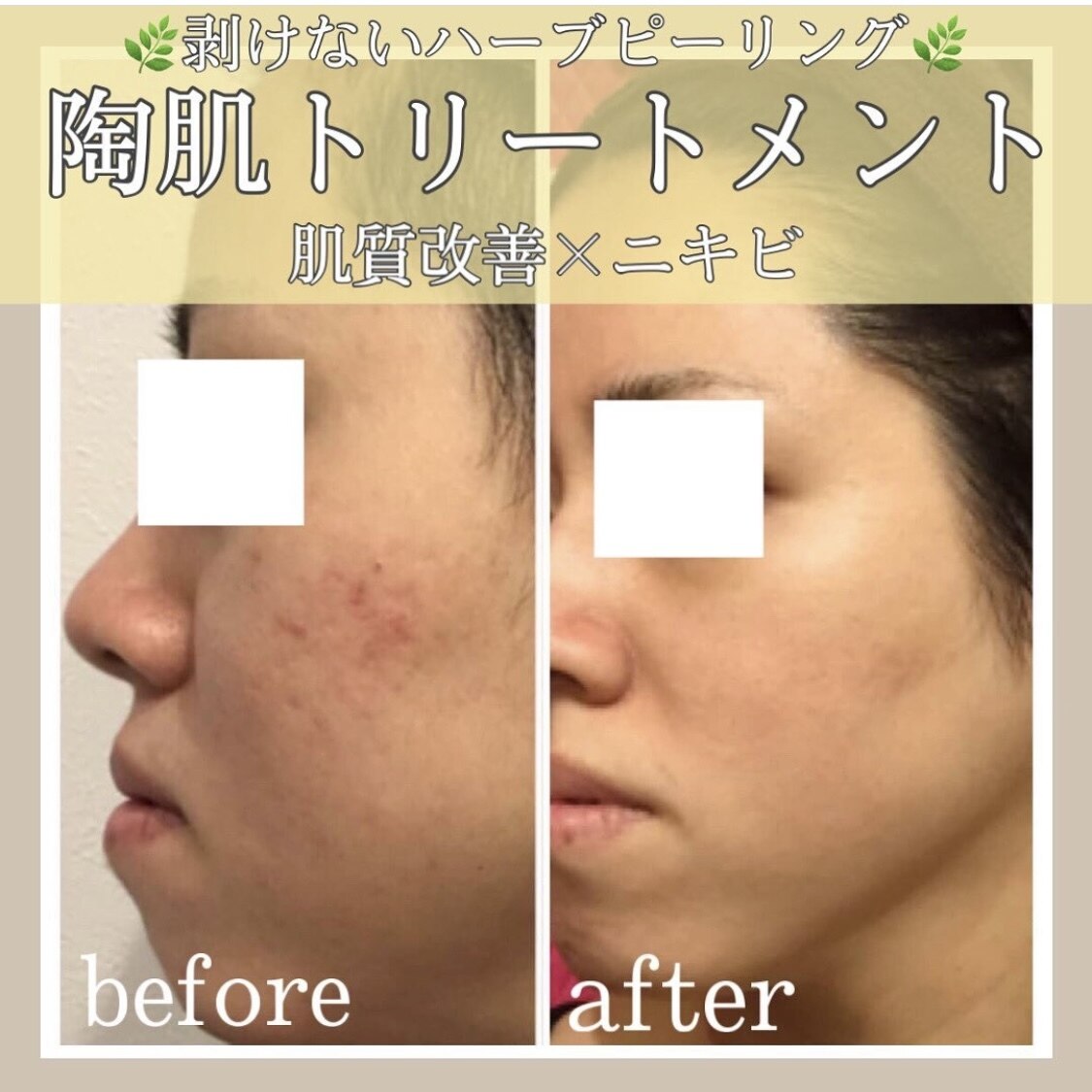 シエスティ｜ホットペッパービューティー