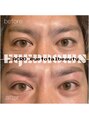 アクロ 高槻店(ACRO) 【メンズ】眉毛アイブロウ、毛量調整、間引き、眉毛ブリーチ