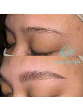 シャロンドットエイチエム(CHALON.HM)/アイブロウリフト