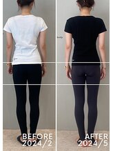 ホリック アイス コア ボディ(HOLIC ICE CORE BODY)/お客様ビフォーアフター4