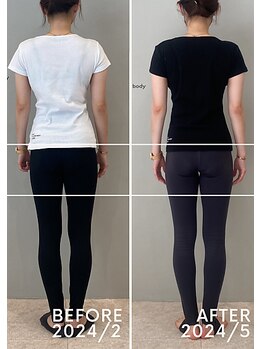ホリック アイス コア ボディ(HOLIC ICE CORE BODY)/お客様ビフォーアフター4