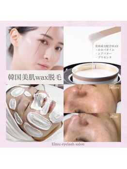 エルミュ(Elmu)/韓国美肌ワックス脱毛