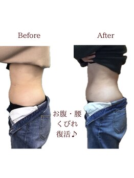 整体院トトノエル 西川原院/Before→After