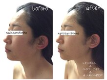 ラヴィソンファム(Ravissant femme)の雰囲気（結果重視小顔〈レモンボトル&ハイパ-ナイフ&水入れヘッドスパ〉）