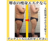 アンディール なかもず店(ANDEAL)