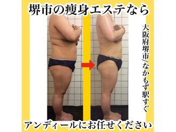 アンディール なかもず店(ANDEAL)