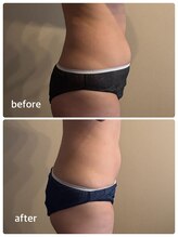 ナイスデイ(Niceday!)/ウエスト集中　