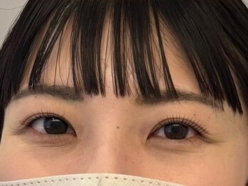 ルッカ(LUKKA)/work by Sakura ラッシュリフト