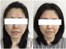 美容整体 ウェリナ 蟹江院/小顔矯正/骨盤矯正/美脚サロン 