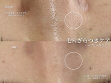 コウル 川西能勢口店(geoul)/透明感アップコース3回