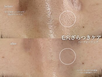 コウル 川西能勢口店(geoul)/透明感アップコース3回