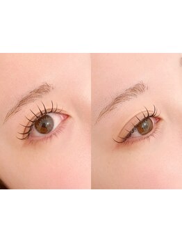 まつげのお悩み解決サロン