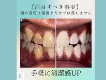 ライトビューティー 関内店(LIGHT BEAUTY)