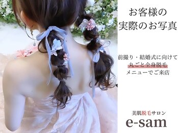 イーサム(e-sam)/丸ごと全身脱毛