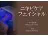 ニキビケアフェイシャル　30分　　