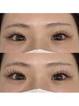 バニーアイズ 天神(Bunny eyes TENJIN)/フラット120本