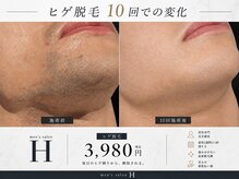 メンズサロン エイチ(H)