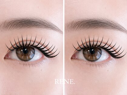 レネ(RENE.)の写真