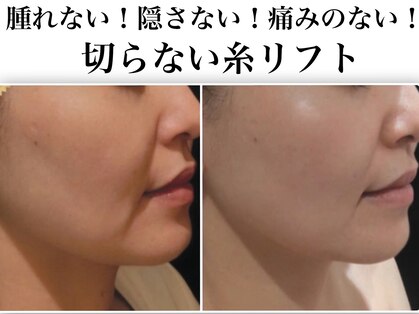 Nビューティーの写真