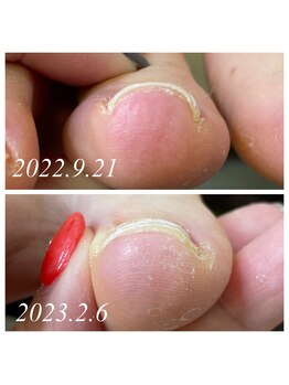 爪屋べっぴん堂/