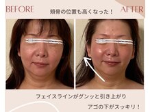 ビューティ エアー ユキ(Beauty air Yuki)