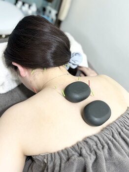 ハリシェンド/全身のお悩みに対応