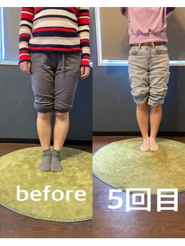 灯(akari)/O脚から美脚へ!20代女性