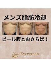 リハーツ(RE;heartz)/★－４℃脂肪冷却導入★